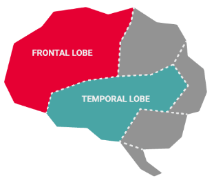 FTD brain diagram